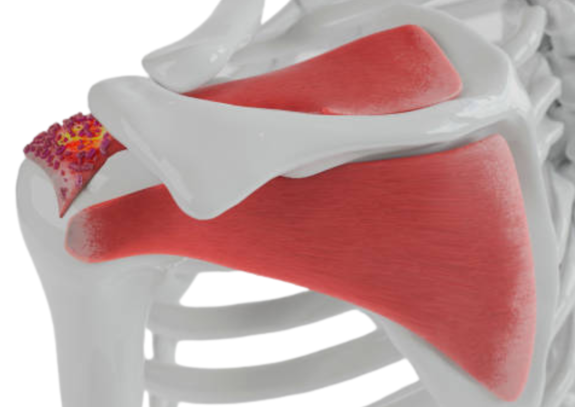 Hombro: manguito rotador, luxaciones…