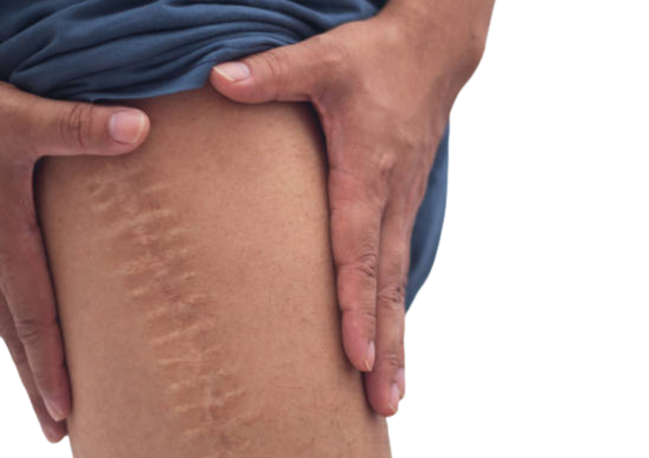 Rehabilitación post-operatoria: prótesis, fracturas…